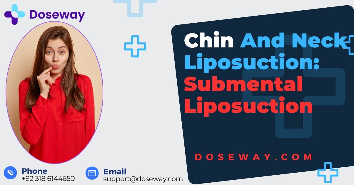 Chin And Neck Liposuction: Submental Liposuction 2 Chin-and-Neck-Liposuction