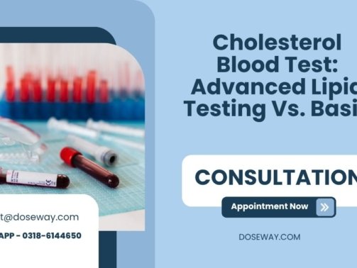 Cholesterol-Blood-Test-Advanced-Lipid-Testing-Vs-Basic