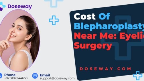 Cost-of-Blepharoplasty-Near-Me
