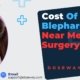 Cost-of-Blepharoplasty-Near-Me