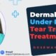 Dermal-Fillers-Under-Eyes
