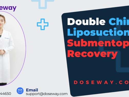Double-Chin-Liposuctions