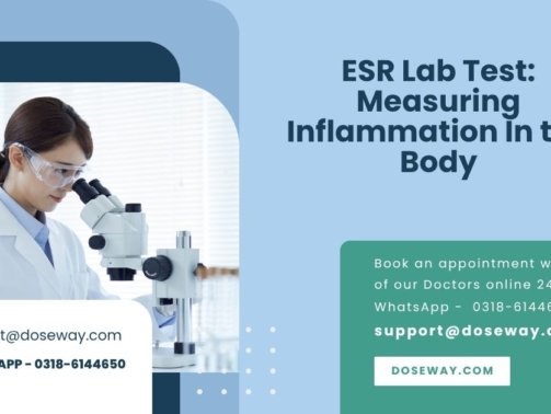 ESR-Lab-Test-Measuring-Inflammation-In-the-Body