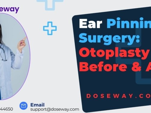 Ear-Pinning-Surgery