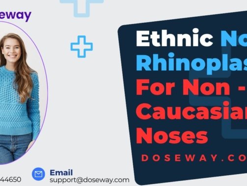 Ethnic-Nose