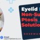 Eyelid-Lifters