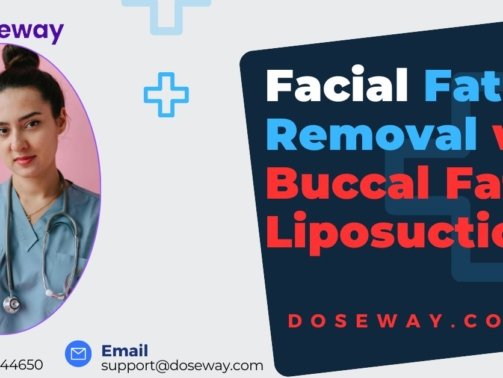 Facial-Fat-Removal