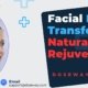 Facial-Fat-Transfer