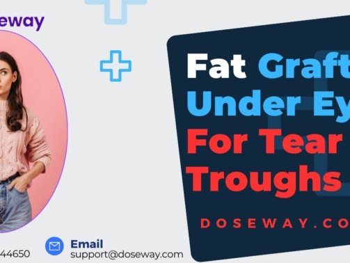 Fat-Grafting-Under-Eyes