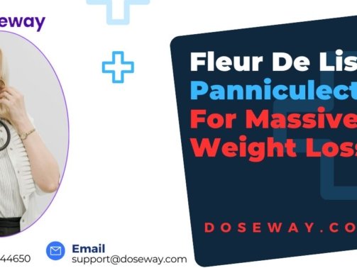 Fleur-De-Lis-Panniculectomy