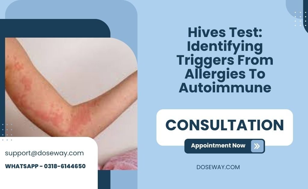 Hives Test: Identifying Triggers From Allergies To Autoimmune 1 Free-Hives-Test-Identifying-Triggers-From-Allergies-To-Autoimmune