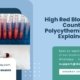High-Red-Blood-Cell-Count-Polycythem-a-Vera-Explained