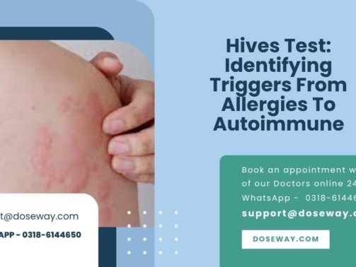 Hives-Test-Identifying-Triggers-From-Allergies-To-Autoimmune