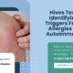 Hives-Test-Identifying-Triggers-From-Allergies-To-Autoimmune