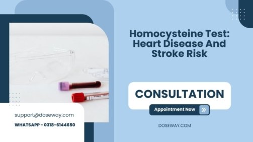 Homocysteine-Test-Heart-Disease-And-Stroke-Risk