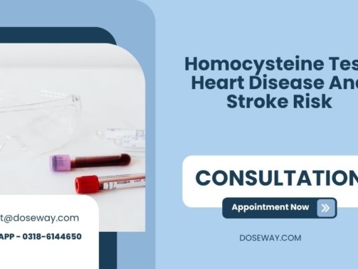 Homocysteine-Test-Heart-Disease-And-Stroke-Risk