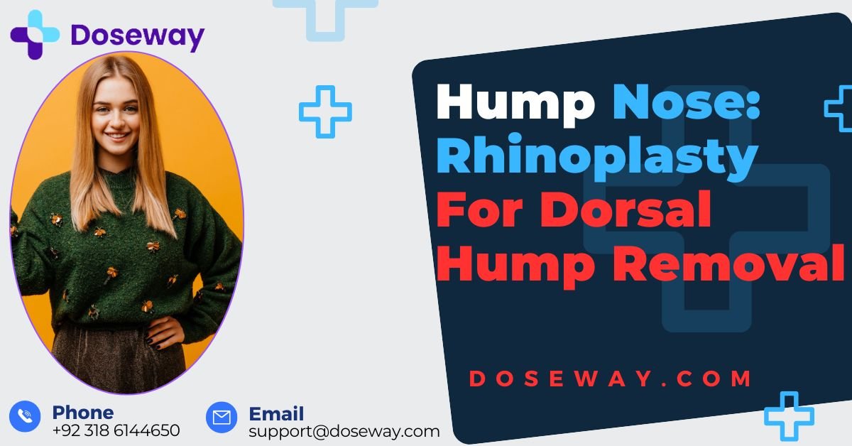 Hump Nose: Rhinoplasty For Dorsal Hump Removal 2 Hump-Nose