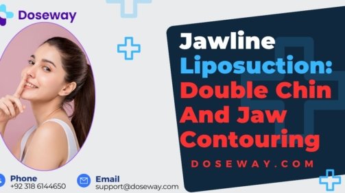 Jawline-Liposuction