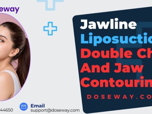 Jawline-Liposuction