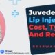 Juvederm-Lip-Injections