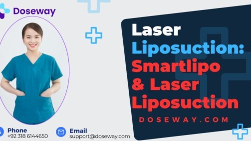 Laser-Liposuction-Treatment