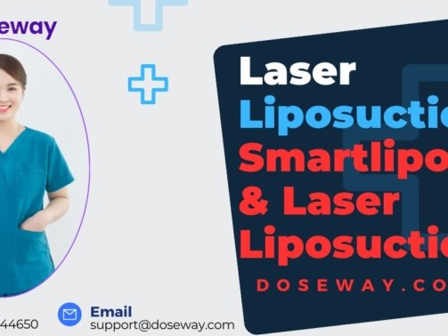 Laser-Liposuction-Treatment