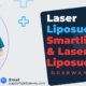Laser-Liposuction-Treatment