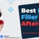 Lip-Filler-Aftercare