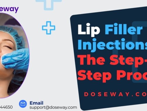 Lip-Filler-Injections