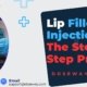 Lip-Filler-Injections
