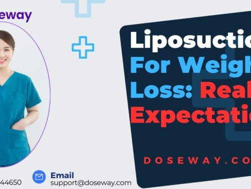Liposuction-For-Weight-Loss