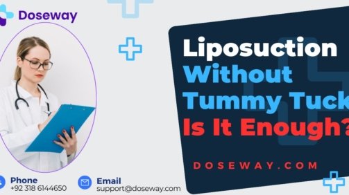 Liposuction-Without-Tummy-Tuck