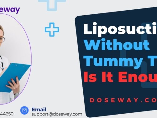 Liposuction-Without-Tummy-Tuck