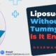 Liposuction-Without-Tummy-Tuck