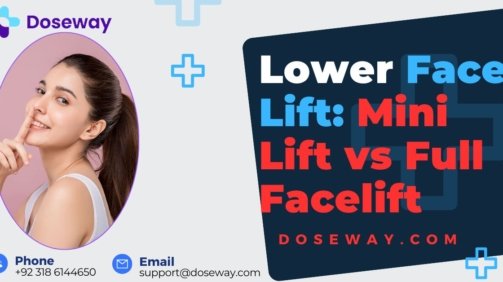 Lower-Face-Lift