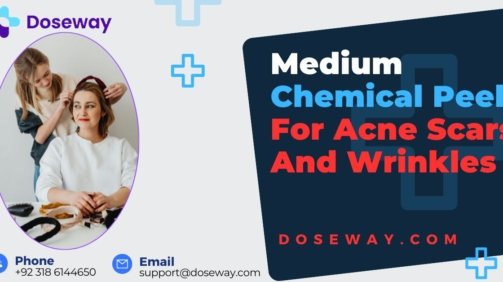 Medium-Chemical-Peel