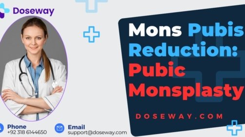 Mons-Pubis-Reduction