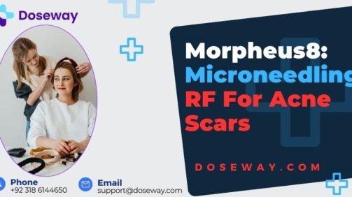 Morpheus8-Microneedling-RF-For-Acne-Scars.jpg