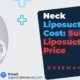 Neck-Liposuction-Cost