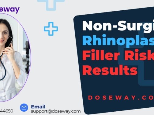 Non-Surgical-Rhinoplasty-Filler