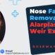 Nose-Fat-Removal