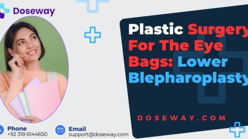 Plastic-Surgery-For-Eye-Bags