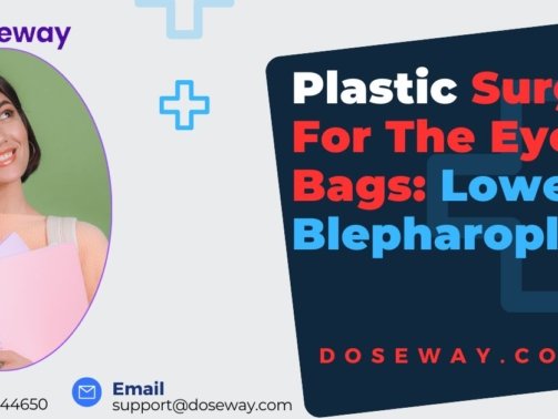 Plastic-Surgery-For-Eye-Bags