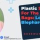 Plastic-Surgery-For-Eye-Bags
