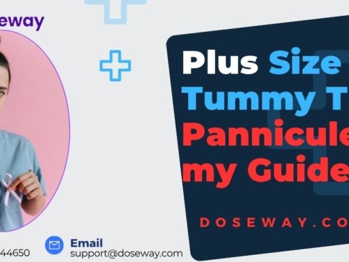 Plus-Size-Tummy-Tuck