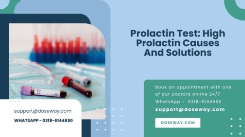 Prolactin-Test-High-Prolactin-Causes-And-Solutions