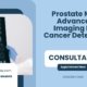 Prostate-MRI-Advanced-Imaging-For-Cancer-Detection