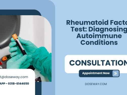 Rheumatoid-Factor-Test-Diagnosing-Autoimmune-Conditions