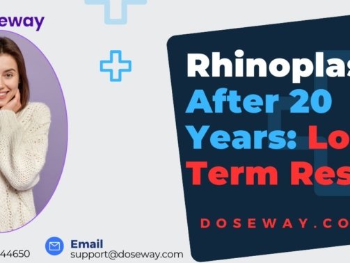 Rhinoplasty-After-20-Years