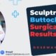 Sculptra-For-Buttocks